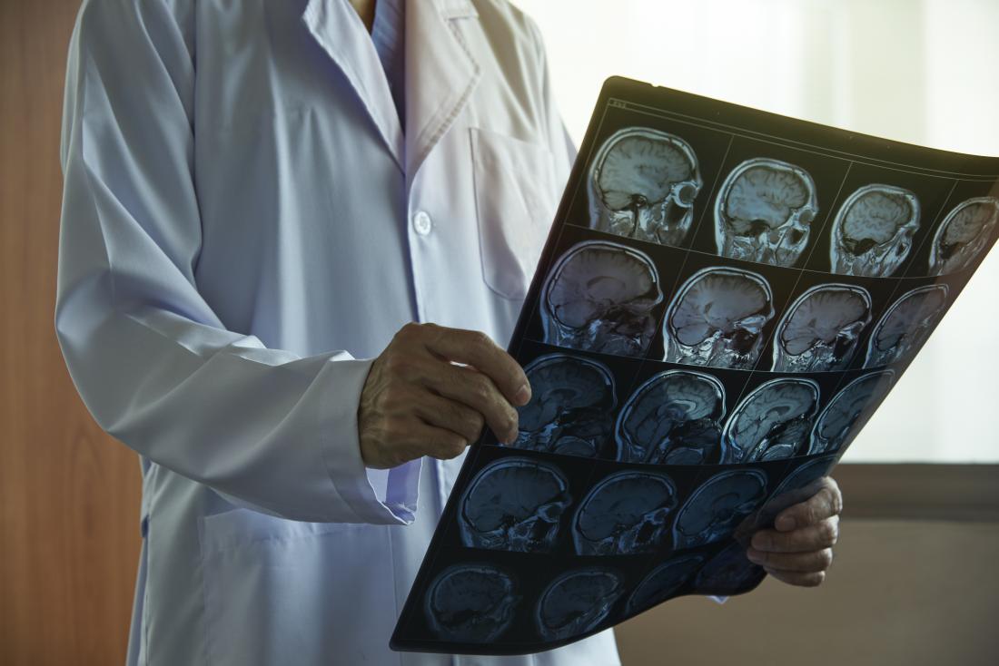 Neurologist looking at brain scans to decide if to use a ventriculoperitoneal shunt