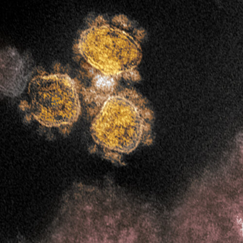SARS-CoV-2 particles.